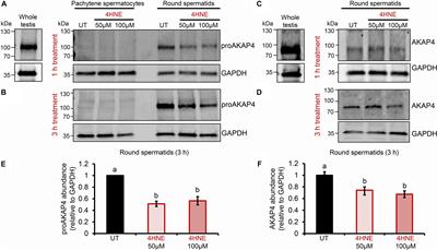 A Kinase Anchor Protein 4 Is Vulnerable to Oxidative Adduction in Male Germ Cells